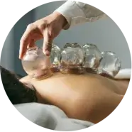 Cupping