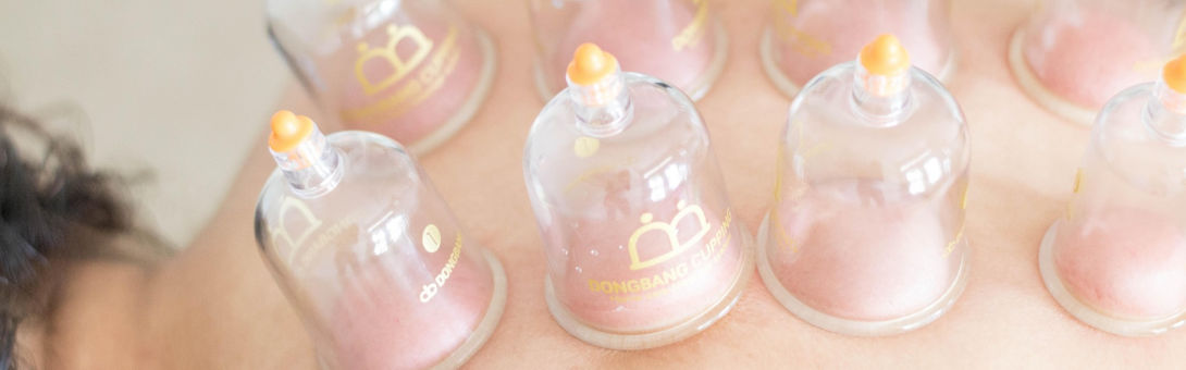 Cupping Individual The Basics and Benefits of Cupping Therapy | Simple Harmony